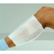 X-Span Dressing Retainers